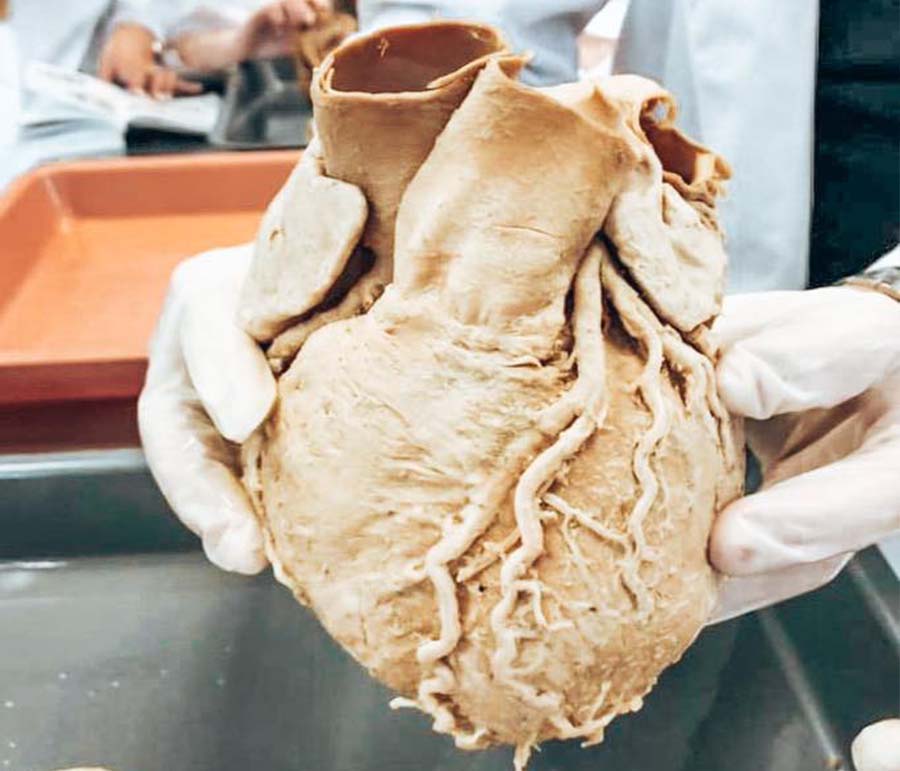 The dissection program